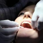 Dental Insurance - Study - Dental Work - Dentist