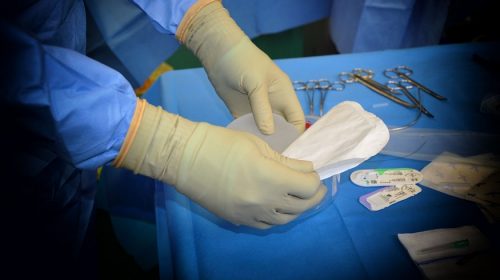 Gender affirming surgery insurance - surgeon with breast implant