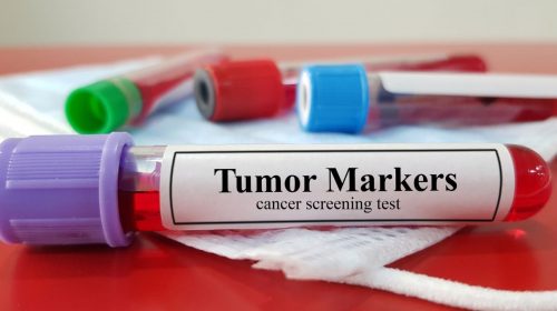 Health insurance - Cancer biomarker test