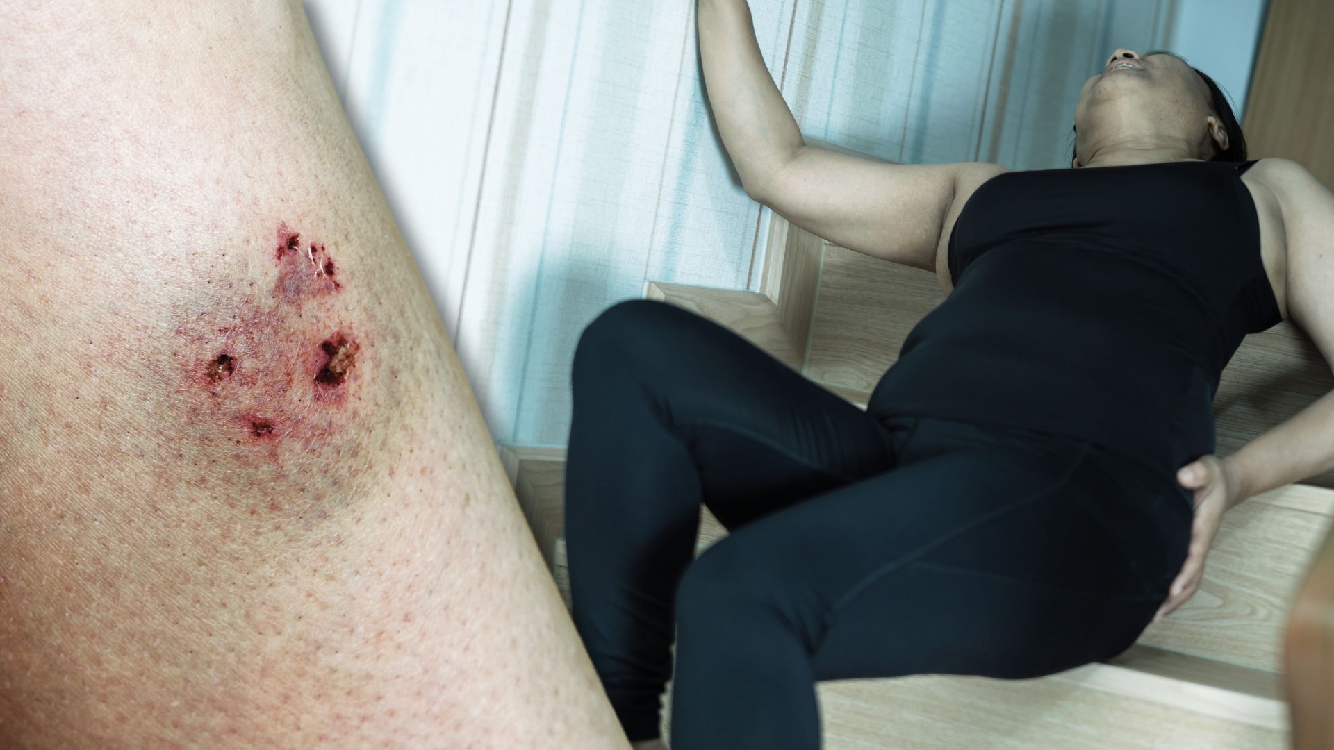 Home Accidents